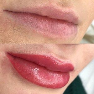 Labios